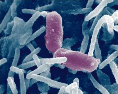Enlarged image of undefined microorganism